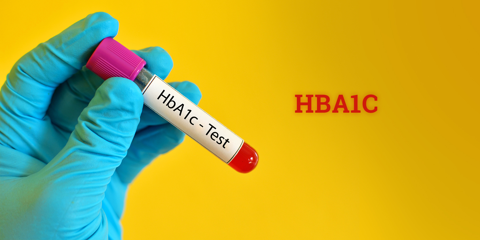 HbA1c Test