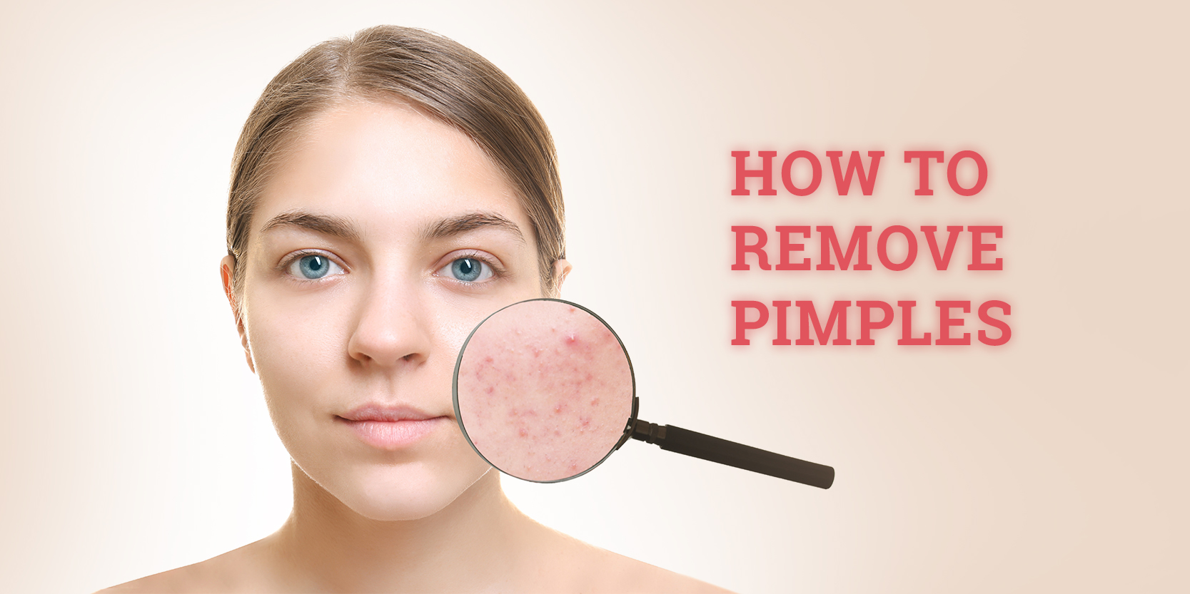 5 Tips by physicians on how to remove pimples and pimple marks